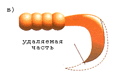 Удаляемая часть